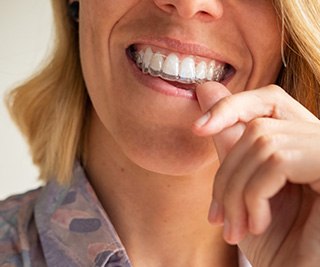 Nose-to-neck view of woman in collared shirt pressing Invisalign over her teeth